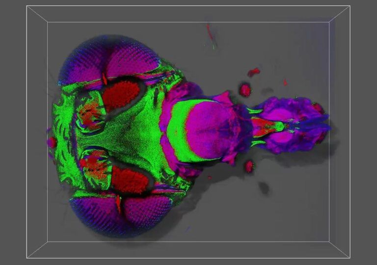 Avances en glioblastoma: modelos alternativos de investigación y reposicionamiento de fármacos